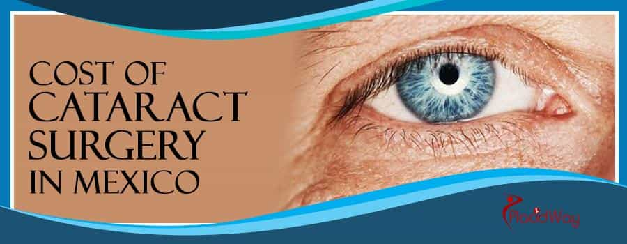 Cataract Surgery In Mexico